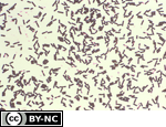 Classification of Bacteria and Archaea