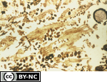 Oribatid mite fecal pellets; decomposing leaves; sporangium