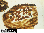 Fecal pellets of Oribatid mites