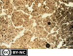 Subangular blocky microstructure