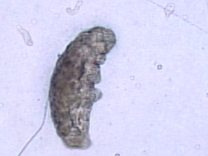 water bear microbe