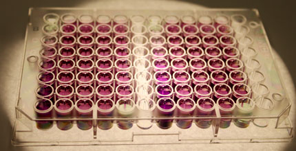 Rows and colunns of pink-tinted test tube samples